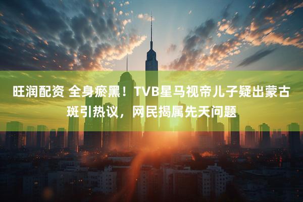 旺润配资 全身瘀黑！TVB星马视帝儿子疑出蒙古斑引热议，网民揭属先天问题